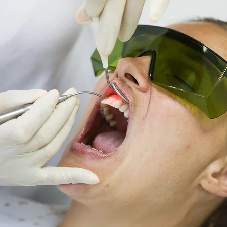 Dentist Encino CA Laser Dentistry BOX